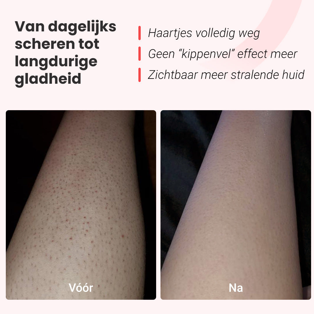 IPL foto-epilator Hilda