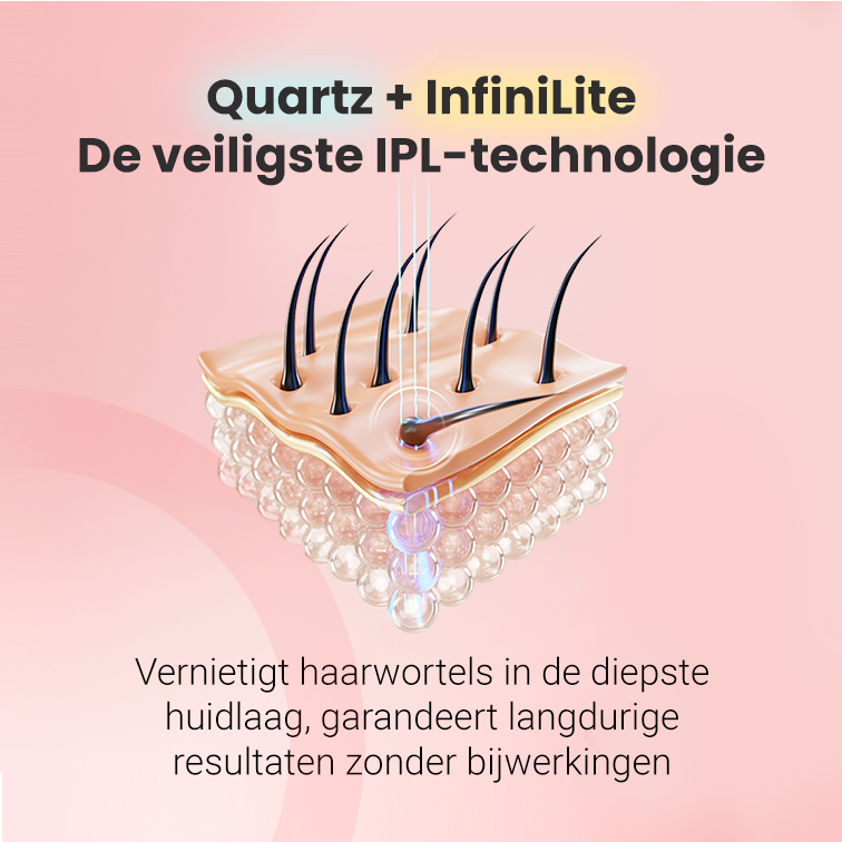 IPL foto-epilator Hilda