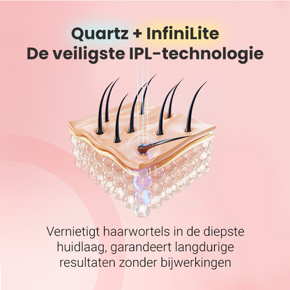 IPL foto-epilator Hilda